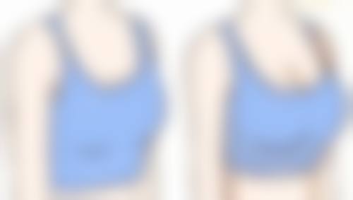 北京圣嘉新医疗美容医院双眼皮手术适合吗，会显老吗？