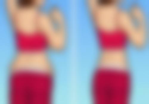 沈阳美莱医疗美容医院双眼皮埋线线断裂受哪些因素影响？