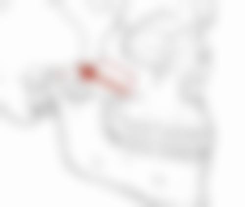 沈阳杏林整形做去眼袋手术，生理期做适合吗