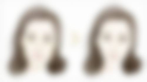 Motiva隆胸假体在韩国医院靠谱吗？