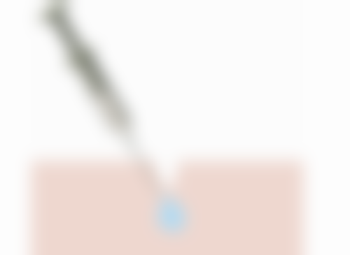 西安莲湖西交疤痕治疗疤痕增生多久可以软化值不值