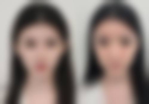 哈尔滨市佳艺医疗美容门诊部真实实例