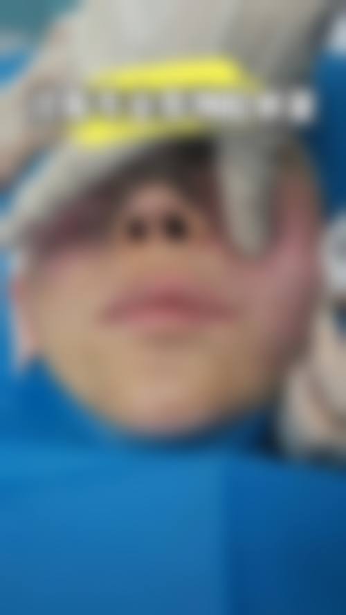 沧州蓝途整形医院价格表