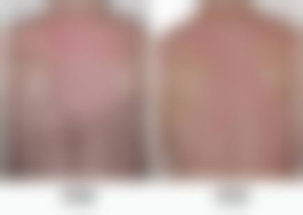 台州大麦植发医院口碑怎么样:消费者的真实评价