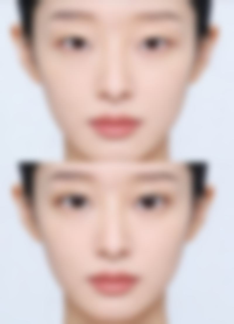 成都军建医院治疗疤痕增生多久可以软化靠谱吗