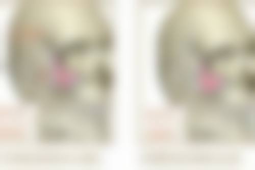 沈阳杏林整形外科医院做耳软骨隆鼻需要住院吗？