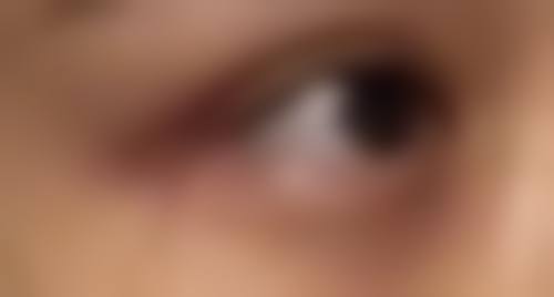 洛阳中信中 心医院真实实例：见证治疗成效