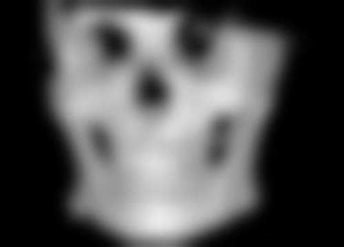 北京圣嘉新医疗美容医院做双眼皮白眼球充血修复慢怎么办？