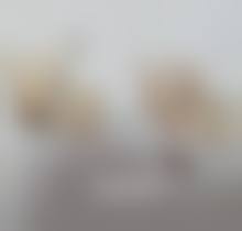 韩国原辰整形外科修复外切眼袋脂肪去多了值不值