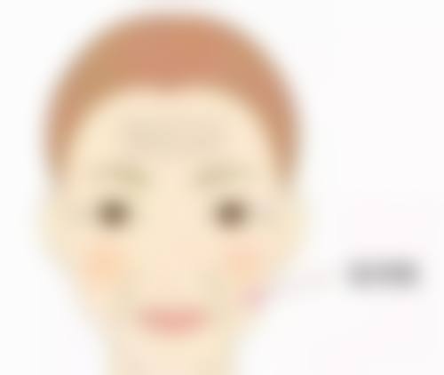 Gabry假体隆胸为何成医美热门之选值不值