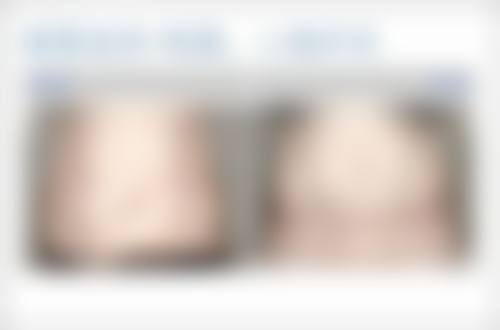 Gabry假体隆胸的品牌背景靠谱吗