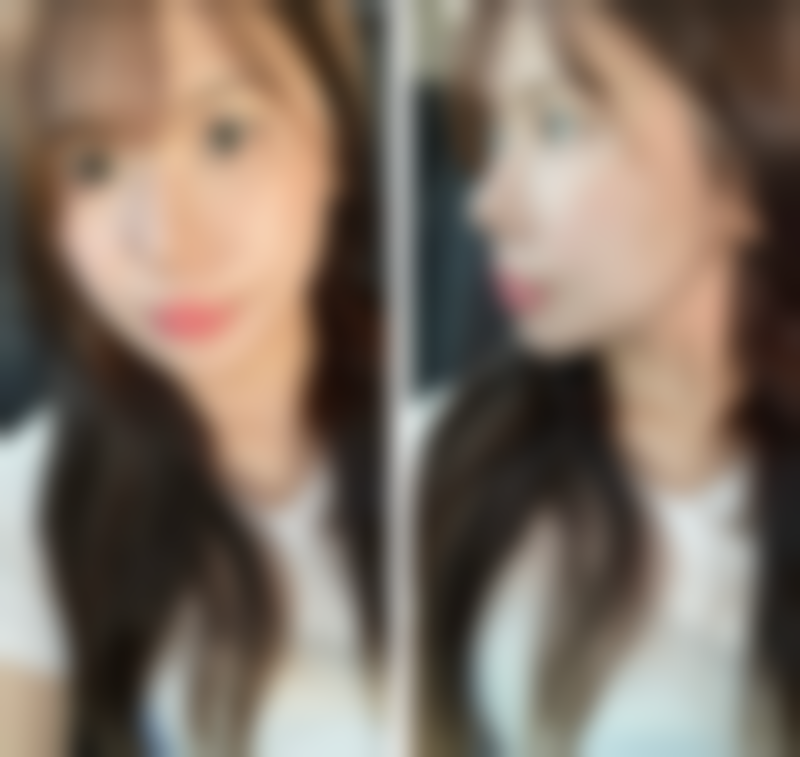 上海奉浦医院整形美容科仪器设备：精良科技助力美丽