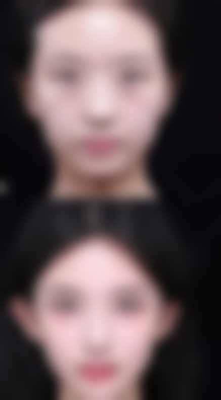 韩国Renovo整形医院仪器设备：高新科技助力美丽升级