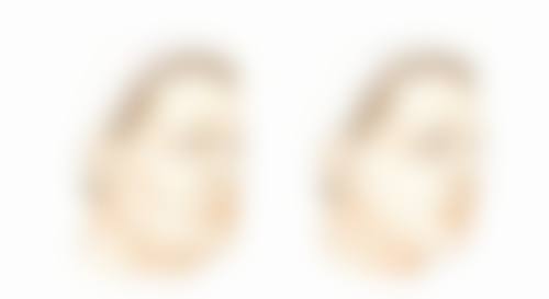 美佳网推荐的医美医院能解决参军疤痕问题吗?