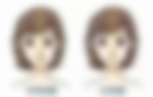 辽宁曙光整形外科医院祛疤适合我吗？