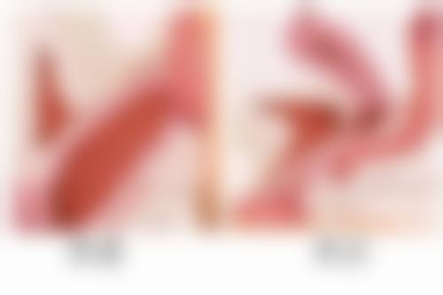 旧疤痕怎么才能去除？权威医美专家揭秘 3 大有效祛疤法，让你的旧疤一扫而光！ 