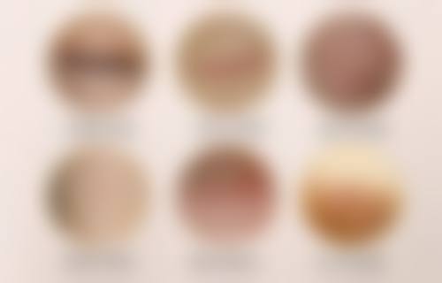 王钟雪医生的技术特点