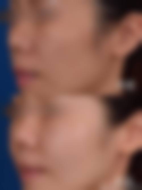 EH（爱护）整形外科擅长项目