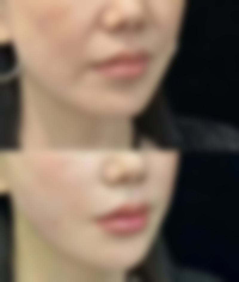 沈阳杏林整形医院消除眼袋的方法靠谱吗？