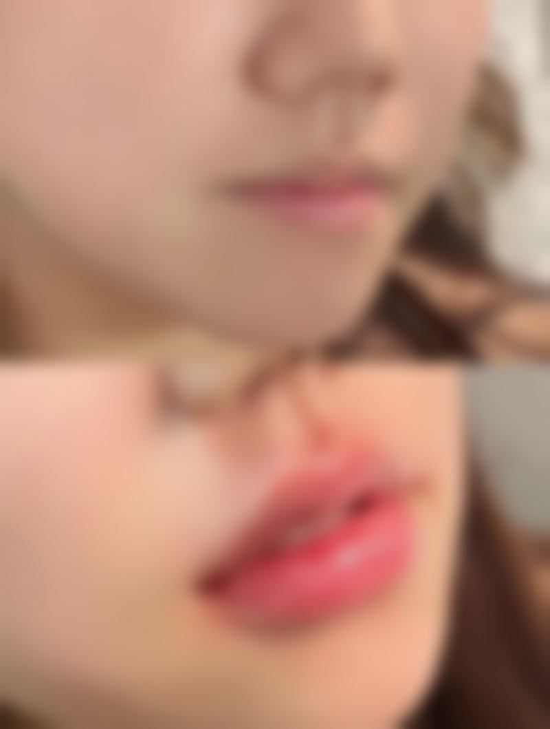 田佩医师的技术特点