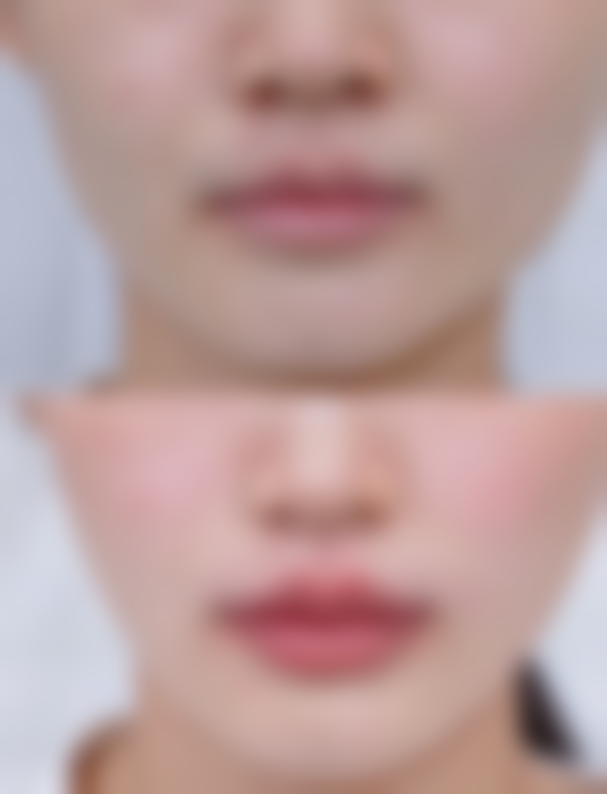 王钟雪医生怎么预约挂号