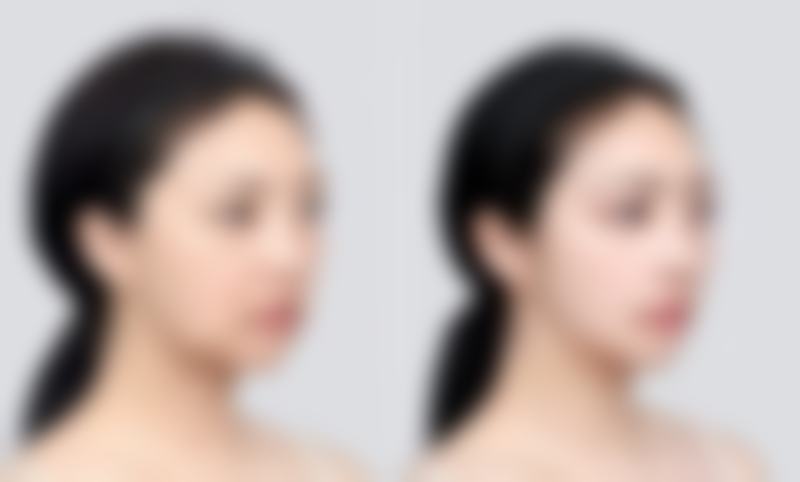 六安瑞妍美整形医院仪器设备：科技助力美丽升级