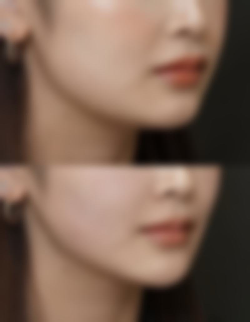 隆胸的3大黄金时期是什么？