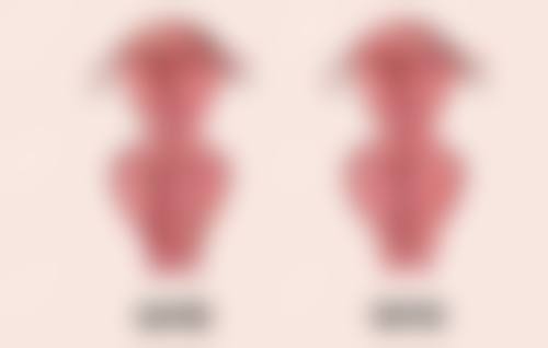 脸部手术疤痕适合参军吗，怎么淡化疤痕?