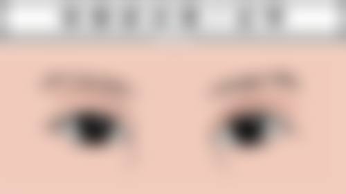 沈阳元辰医疗美容门诊部提眉和双眼皮先做哪个值不值？