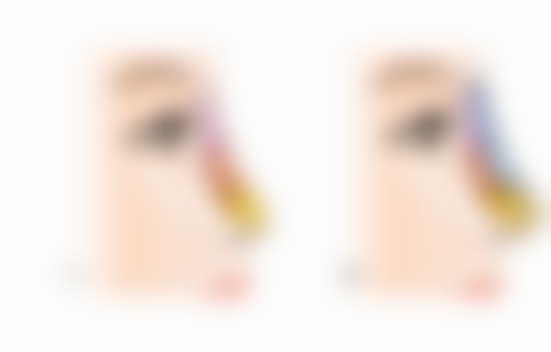 头发种植的条件是什么？满足这5大关键条件，让你轻松拥有浓密秀发，开启自信人生！ 