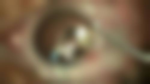 沈阳杏林整形外科医院祛开水烫伤疤痕靠谱吗？