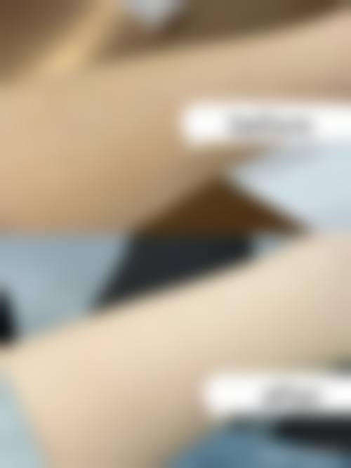 珠海盈美医疗美容门诊部仪器设备:精良科技的助力