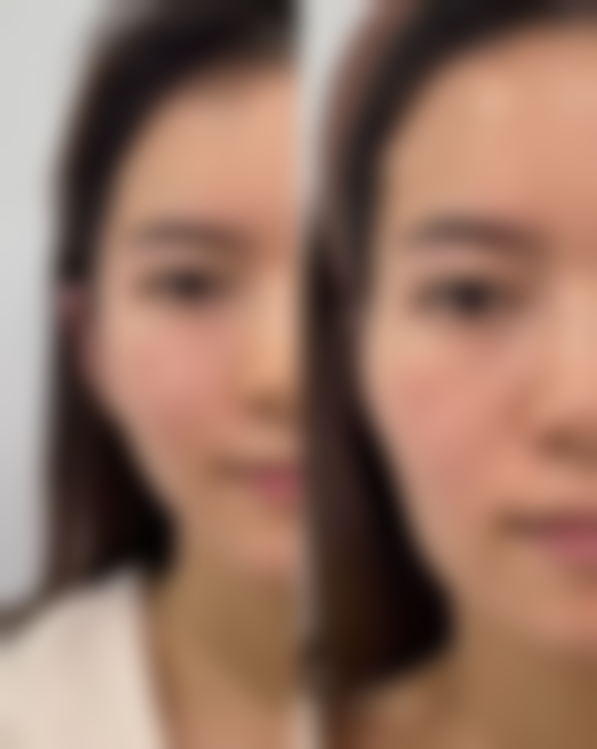 珠海盈美医疗美容门诊部擅长项目:满足你的多样需求