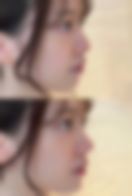 太原美莱整形医院口碑怎么样：求美者的一致好评