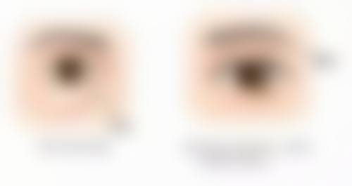 沈阳杏林整形的抽脂靠谱吗？