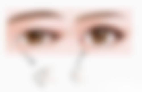 沈阳杏林整形去眼袋靠谱吗？