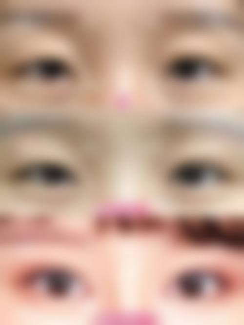 广州现代医院医疗美容科口碑怎么样:极高满意度,见证美丽奇迹