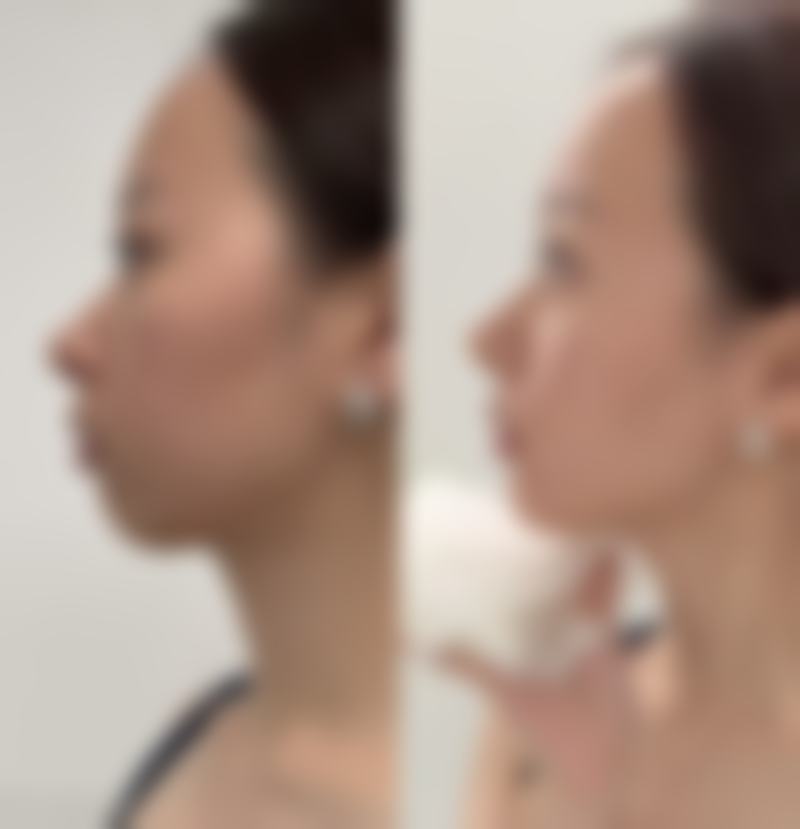 扬州艾菲斯整形地址及乘车路线：轻松抵达美丽殿堂