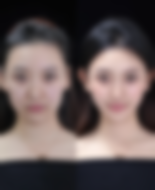 不同医院治疗疤痕妊娠的费用差异大吗，靠谱吗？