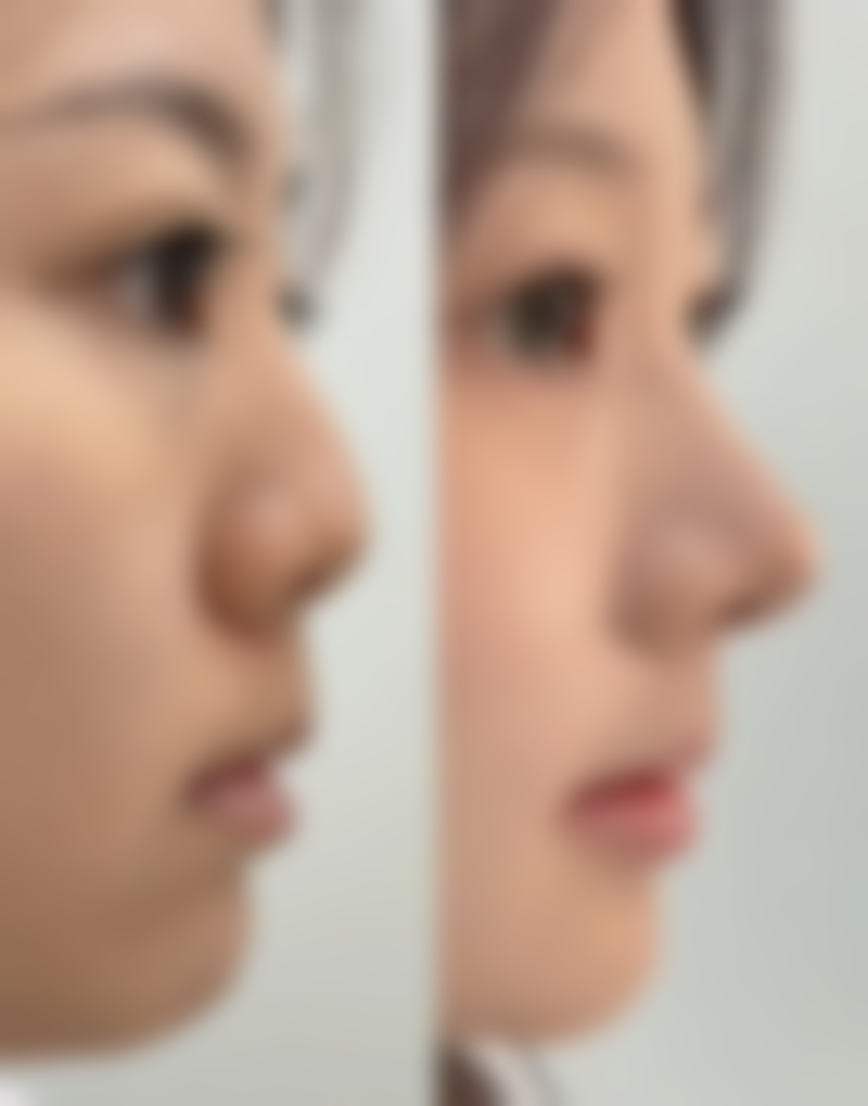 吴玉娟医生擅长项目：全方面守护你的美