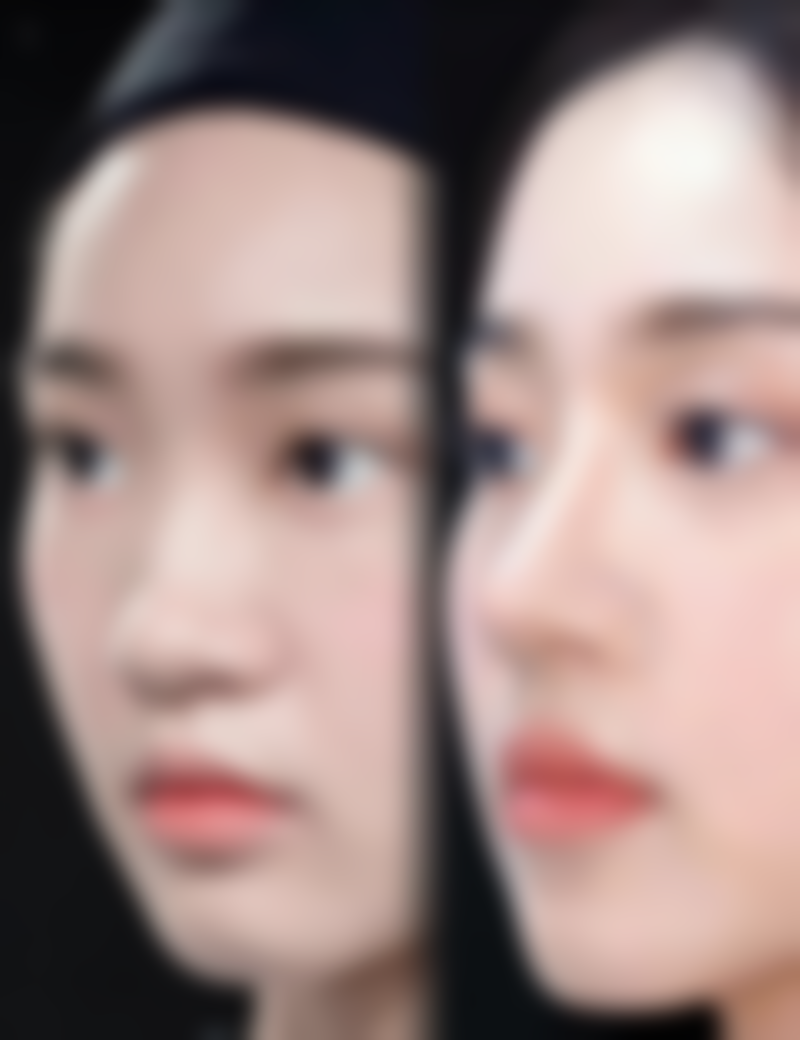 韩国ohkims整形外科医院执业信息：正规靠谱有保护