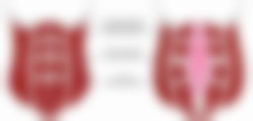 沈阳杏林整形外科医院打完除皱后化妆时间安排怎么样？