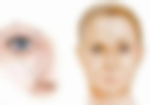 沈阳百嘉丽医疗美容医院割双眼皮后下垂情况普遍吗？