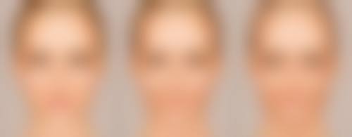 沈阳美莱医疗美容医院割双眼皮后吃芝麻酱对修复有帮助吗