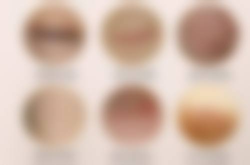 北京嘉禾医疗美容医院割双眼皮后下垂几率受哪些因素影响？