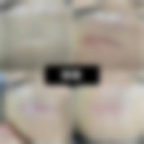 新都美丽阁整形医院口碑怎么样