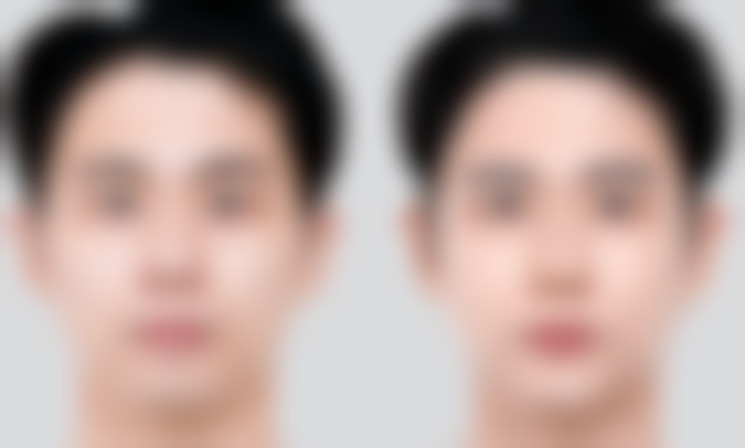 潢川易韩医疗美容诊所预约挂号方式：便捷开启美丽通道