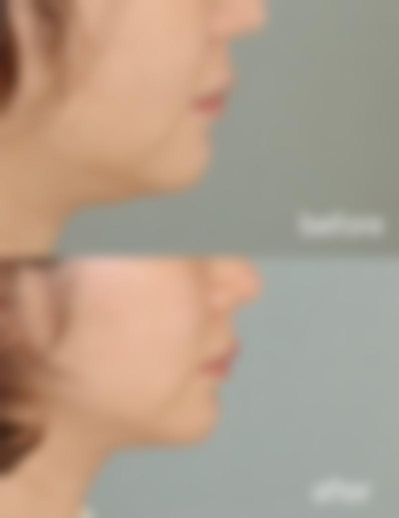 沈阳杏林整形外科医院眼霜辅助去眼袋成效好吗？