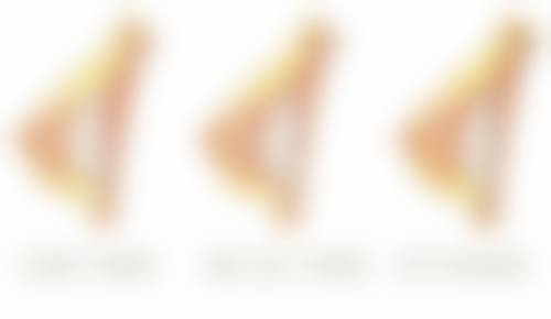 埋线双眼皮多久会消失？揭秘3大影响因素让效果维持5年以上！快了解医美界热门的持久秘诀！ 