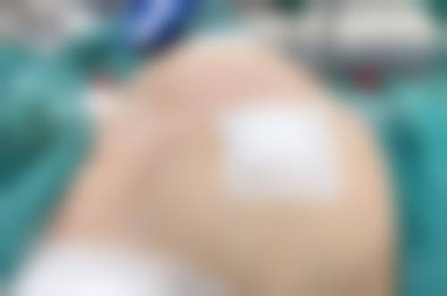 郑州郑飞医院整形科擅长项目：全方面的美丽魔法